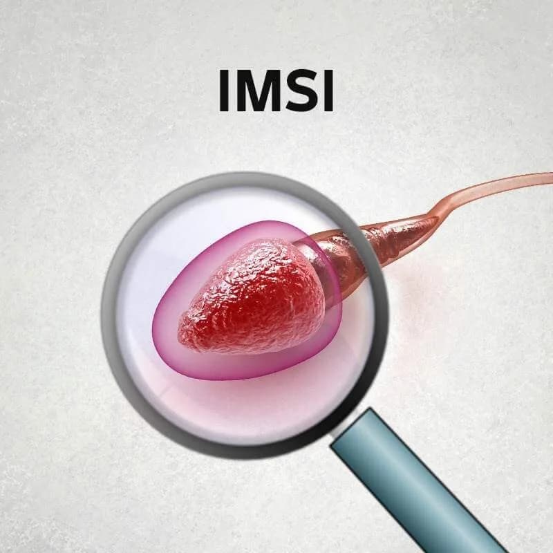 Trusted IMSI Treatment in Delhi | Fertylity IVF Clinic