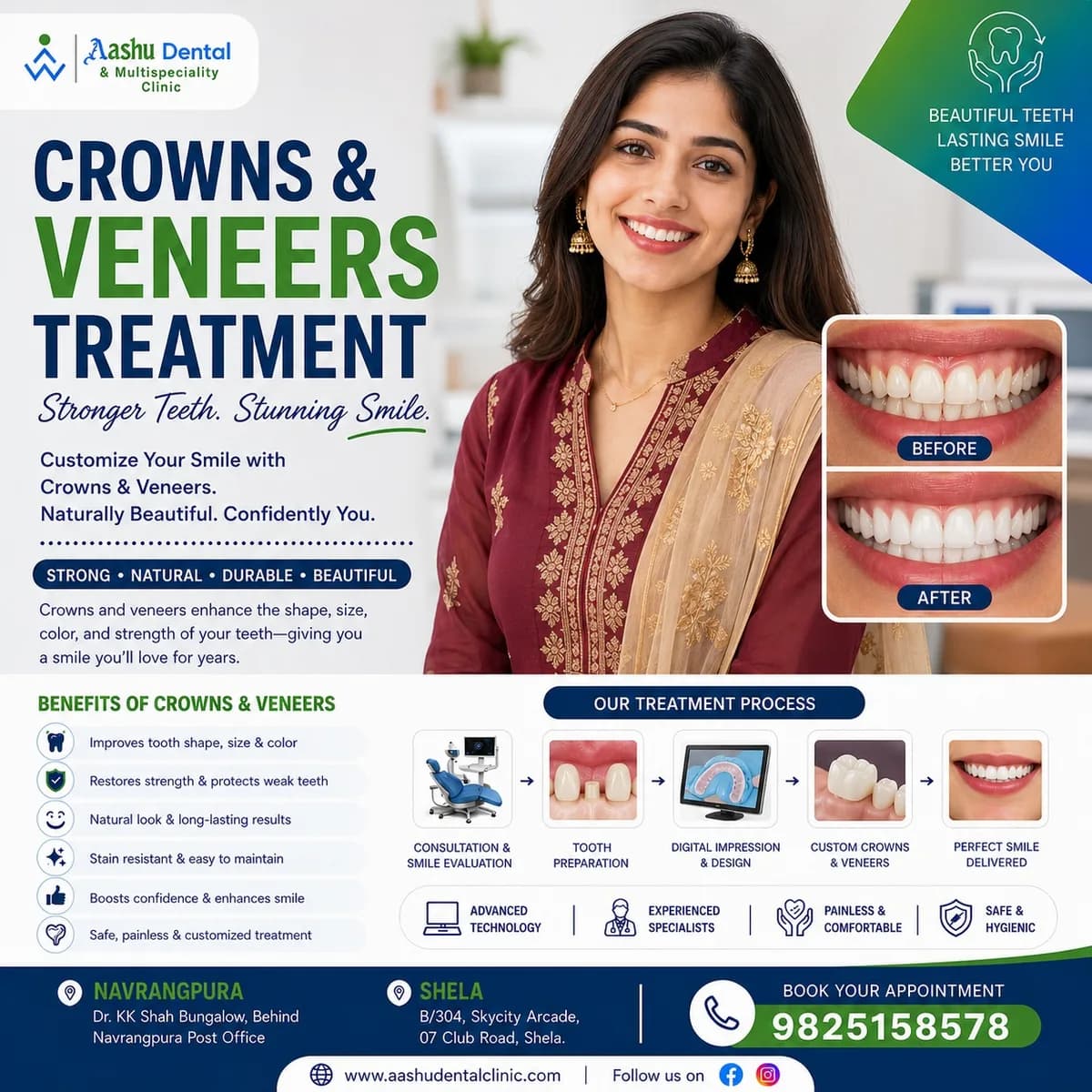 Get a Confident Smile with Crowns & Veneers | DR. Manish Shah