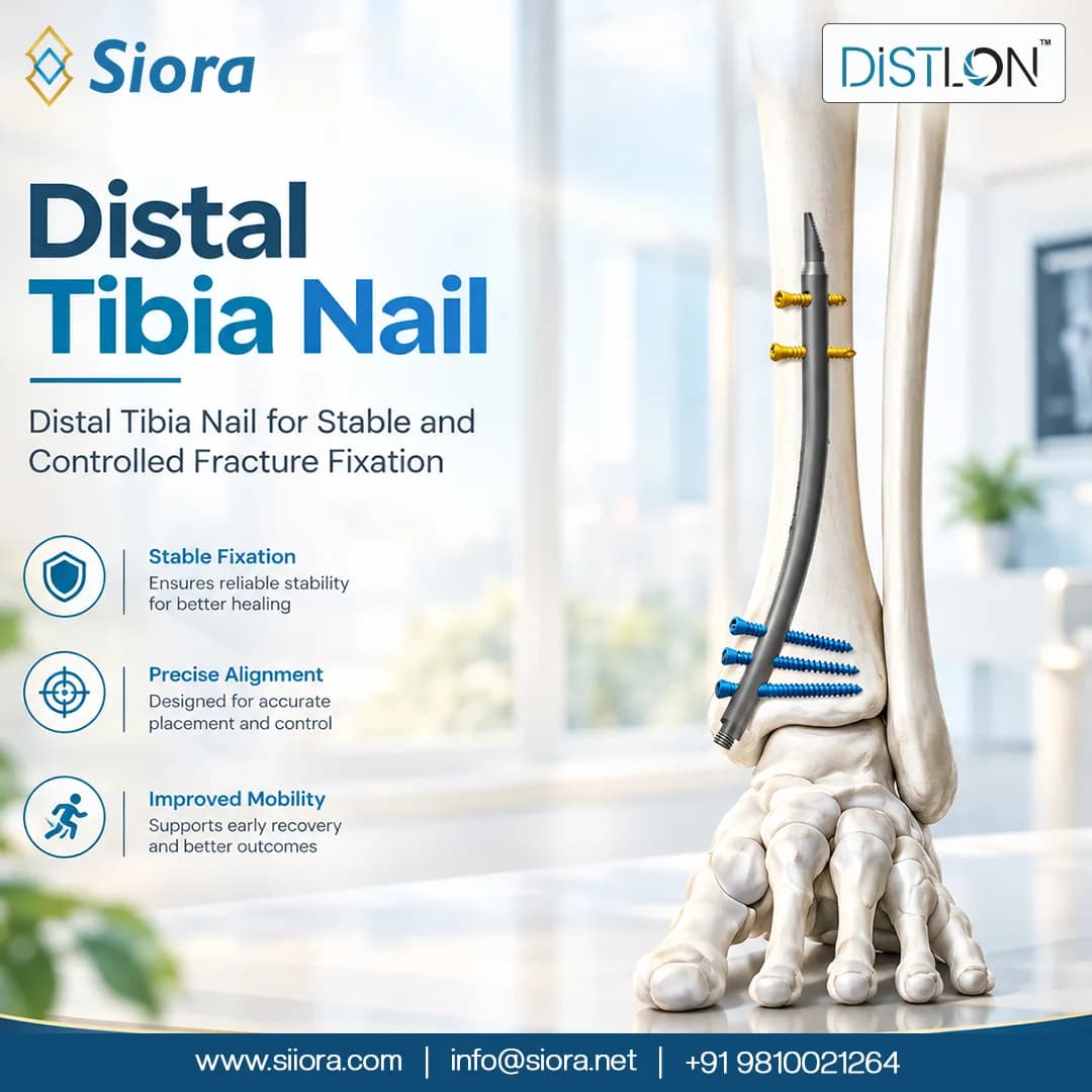 Distal Tibia Nail for Stable and Controlled Fracture Fixation