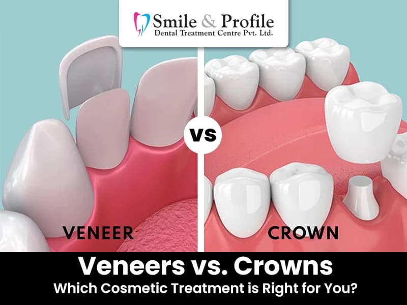 Restore What's Lost Before It Gets Worse