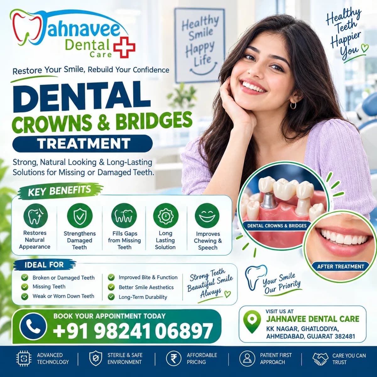Dental Crowns and Bridges Treatment | Jahnavee Dental Care