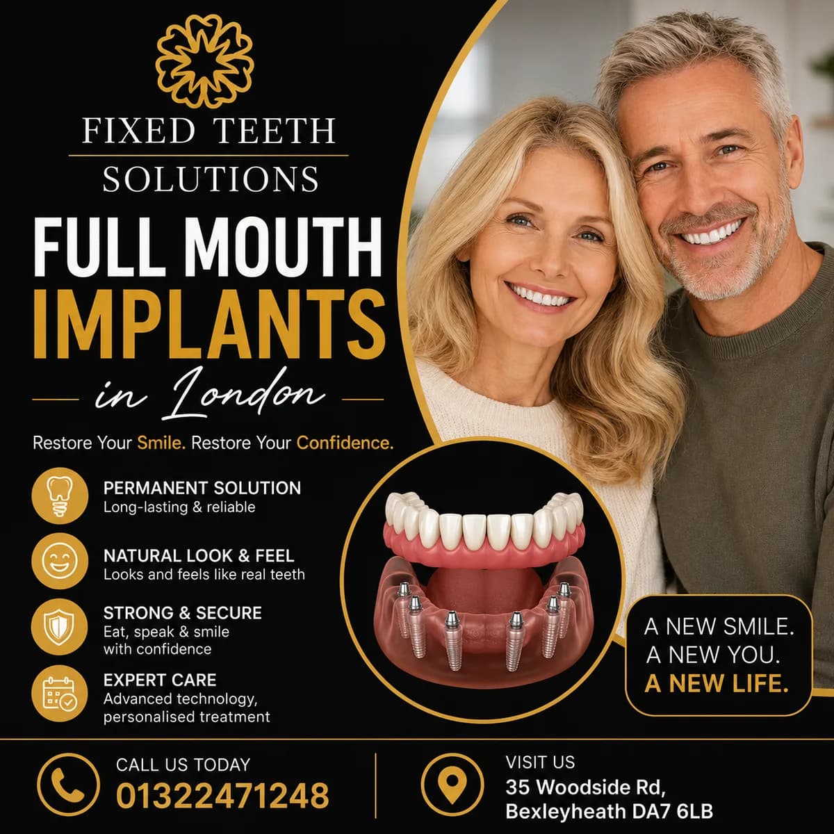 Full Mouth Implants in London: Restore Your Smile with Confidence