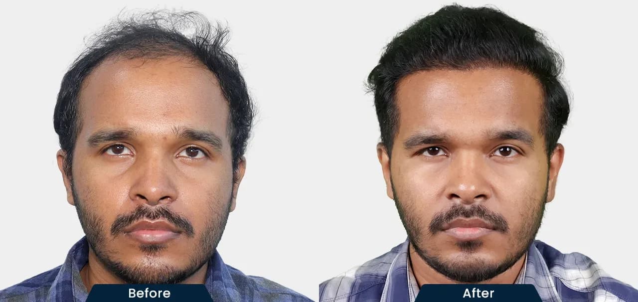 HairFree and HairGrow Clinic-Surat