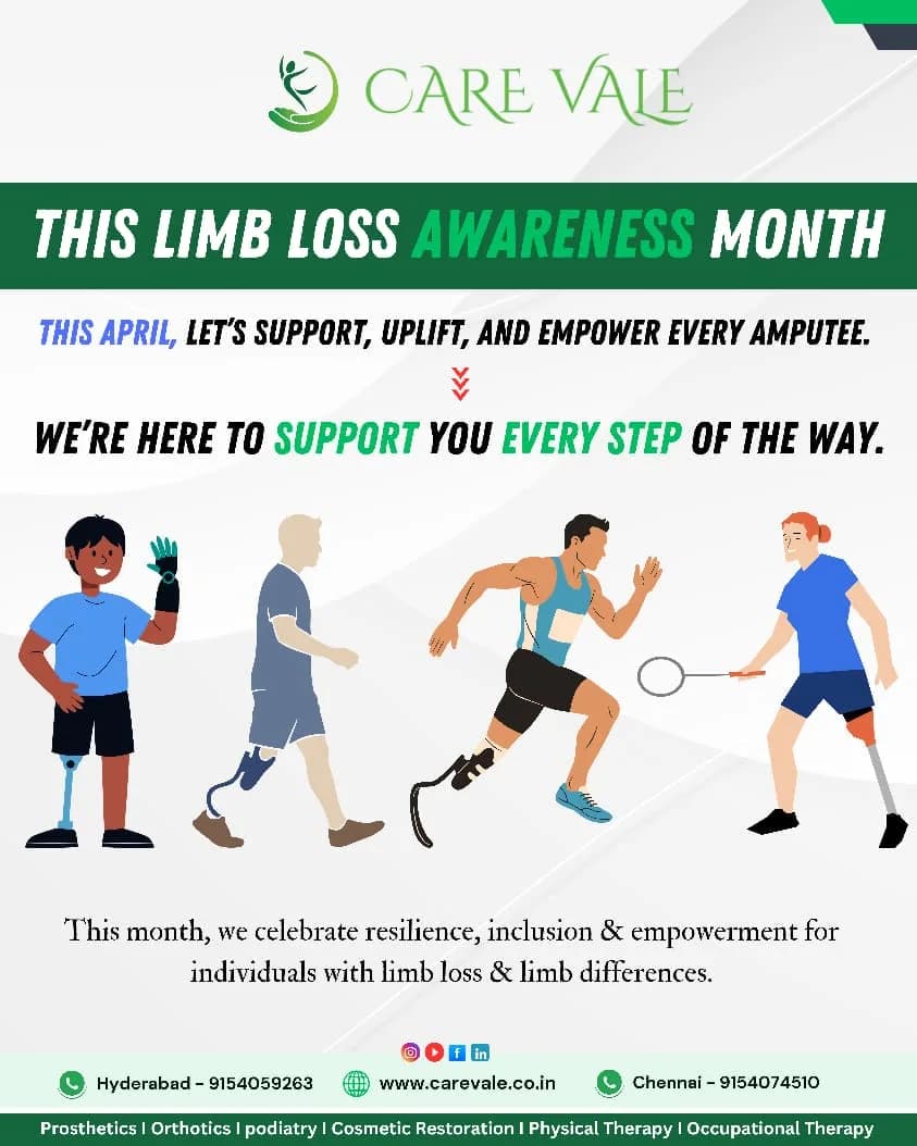<a href="https://www.carevale.co.in/">Best Artificial Leg  in Hyderabad | CareVale Prosthetics</a>