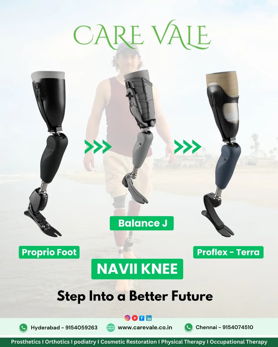 Best Prosthetic Leg Clinic in Hyderabad | CareVale Prosthetics