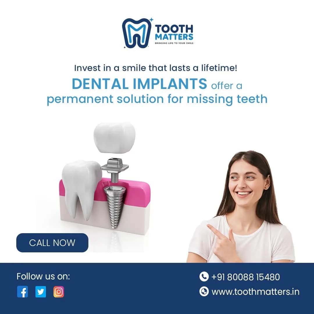 Tooth Matters | Dental Implants from the Best Dental Clinic in Kondapur 