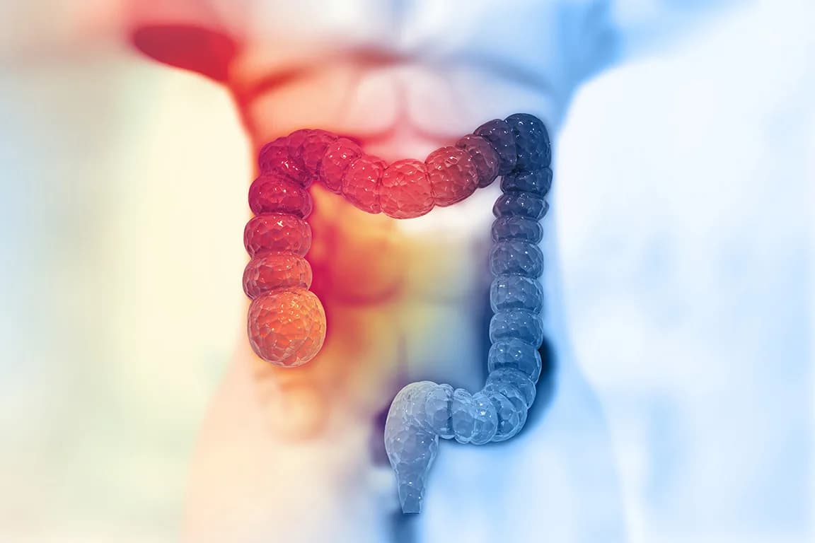 Colon Cancer Care & Treatment in Noida | Dr. Manish Singhal