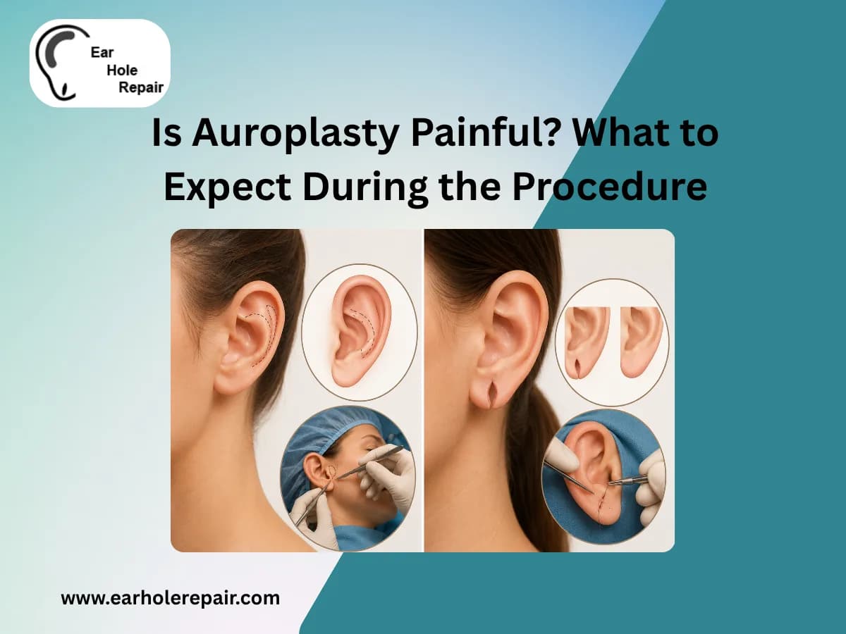 Is Auroplasty Painful? What to Expect During the Procedure