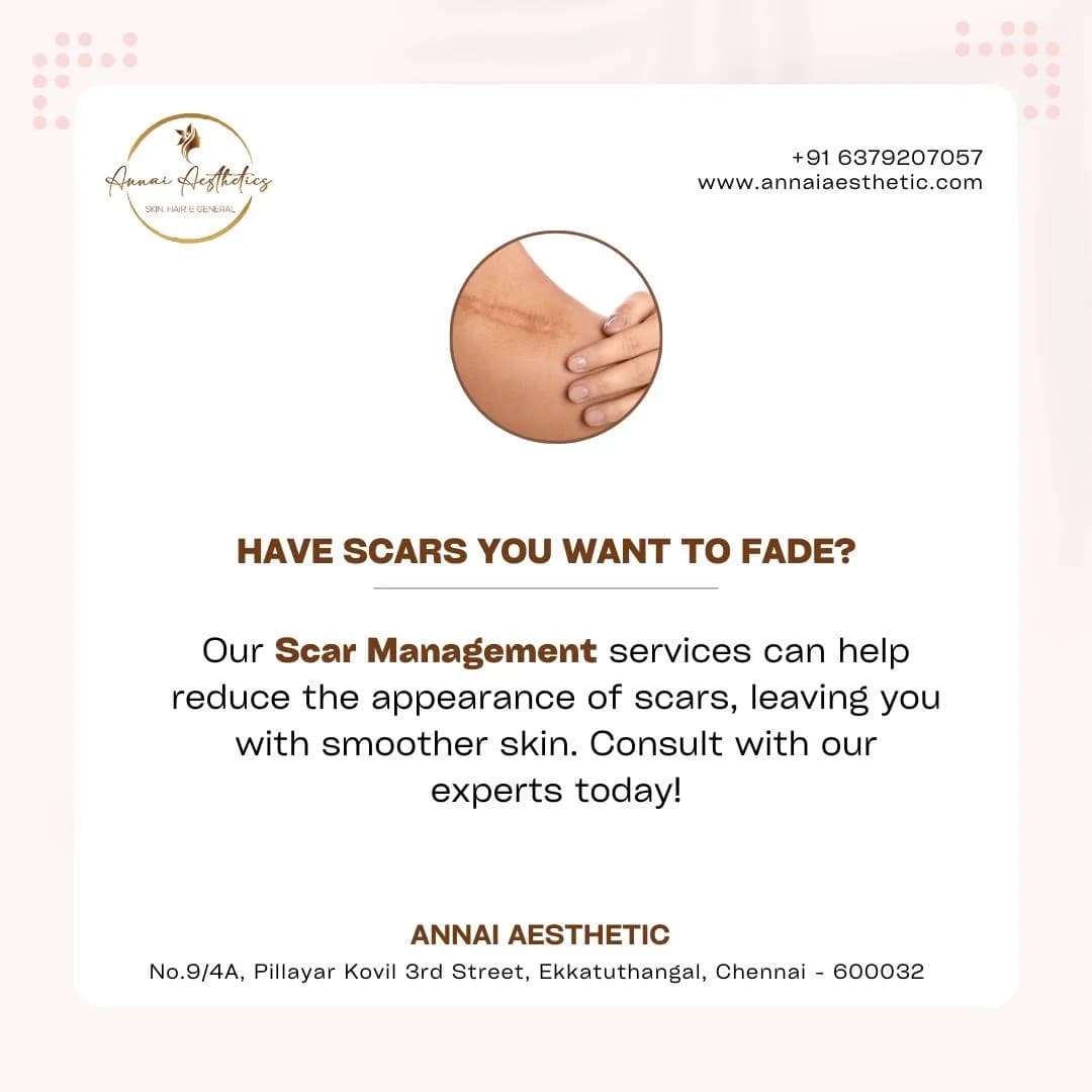 PRP Treatment Near Guindy | Hair Loss & Skin Rejuvenation – Annai Aesthetic Clinic