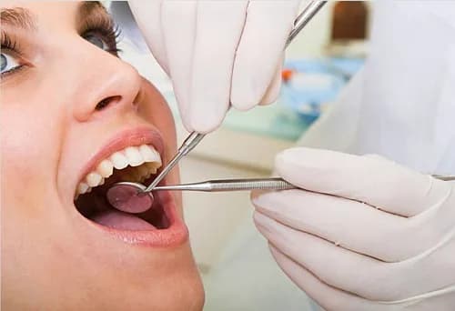 Root Canal Treatment Mount Roskill, Auckland 