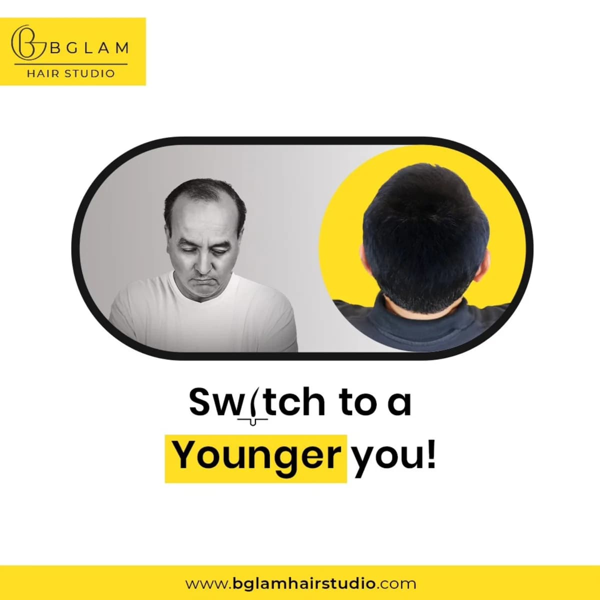 Hair Patch Services in Banashankari, Bangalore | Bglam Hair Studio