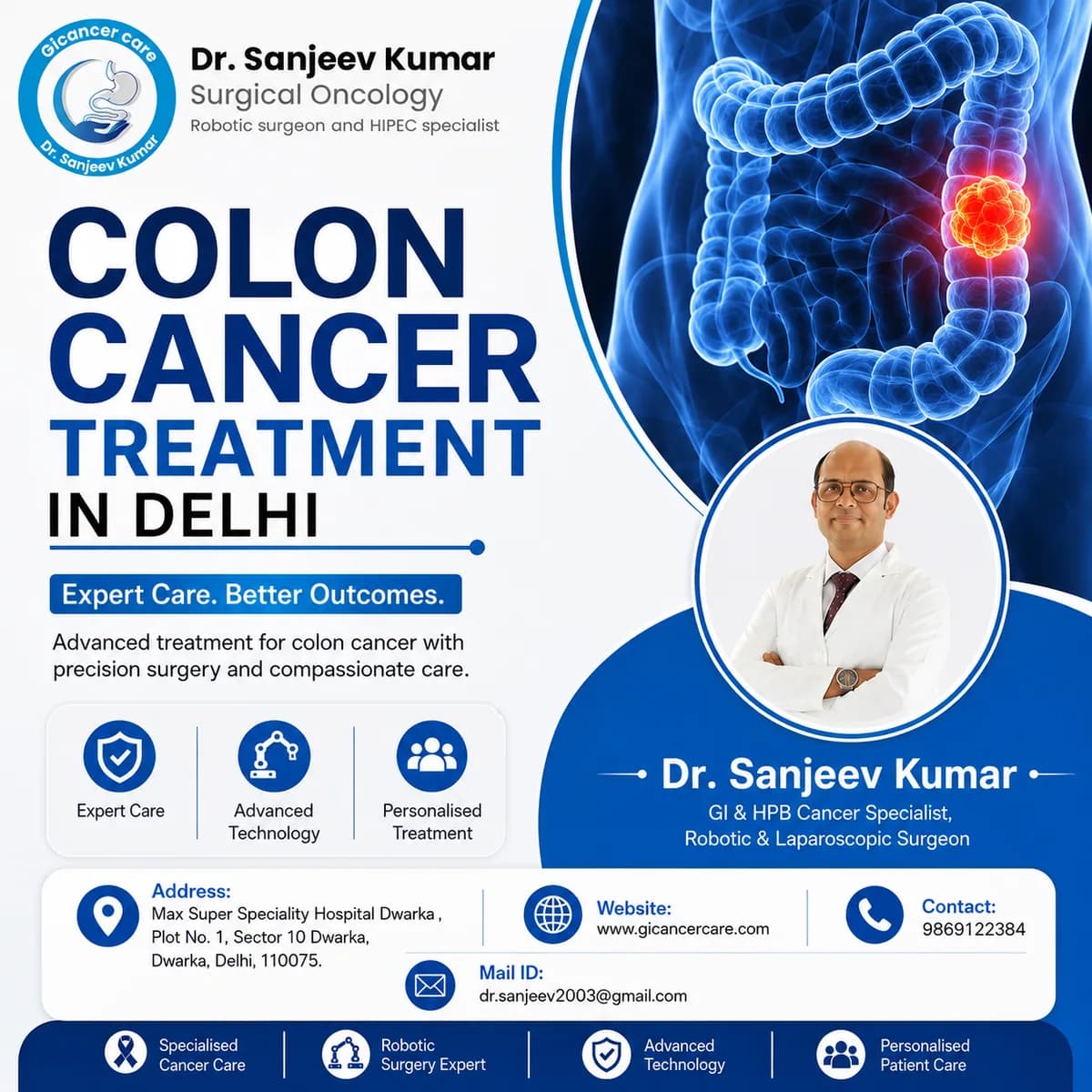 Colon cancer Treatment in delhi