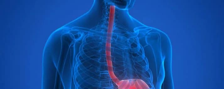 Trusted Esophageal Cancer Doctor in Noida | Cancer Consult