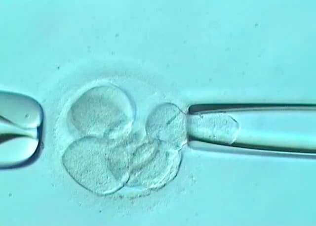 Discover Assisted Embryo Hatching in Delhi at Fertylity IVF