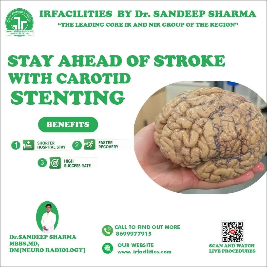 Advanced Carotid Stent Procedure in India