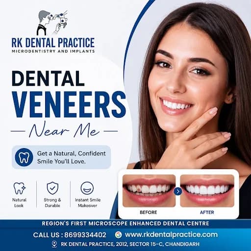  Dental Veneers Near You for a Perfect Smile Transformation