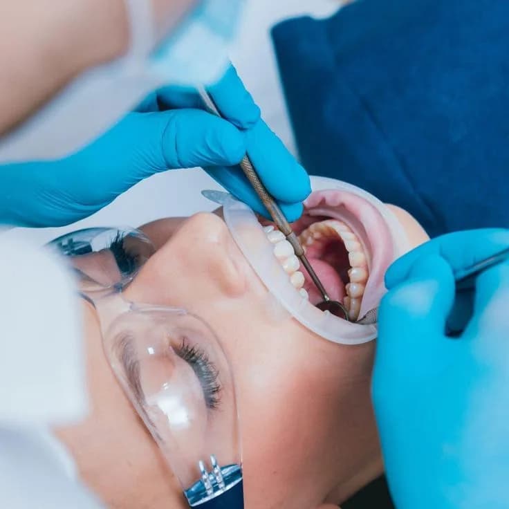 Root Canal Clinic in Ahmadabad – Pain Free RCT Treatment