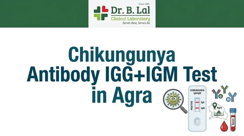 Chikungunya Test in Agra | Differentiate from Dengue & Other Fevers