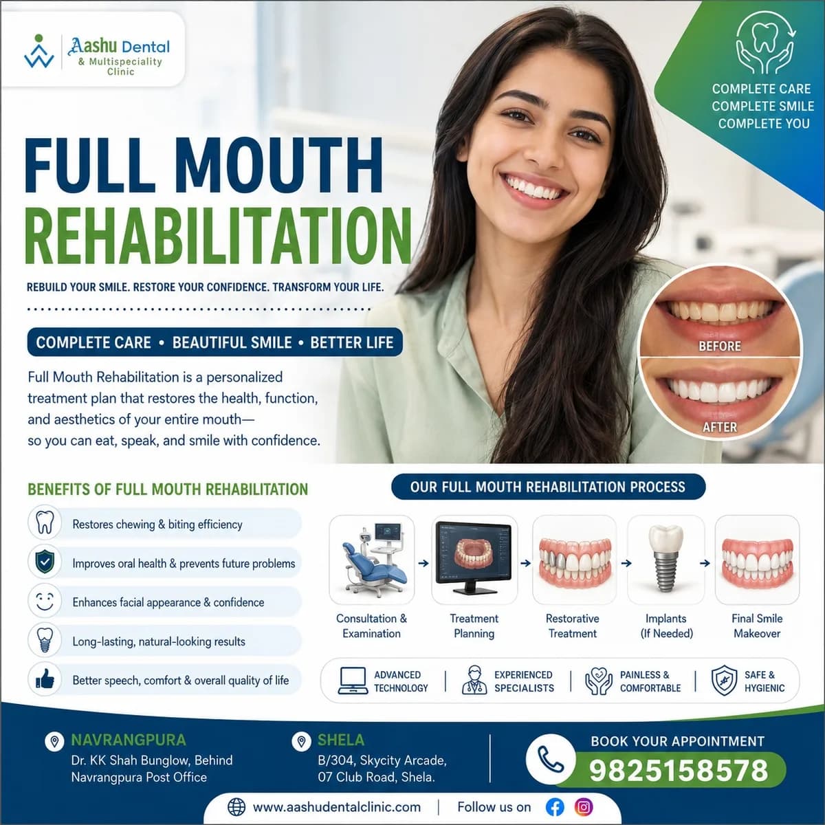 Full Mouth Rehabilitation in Ahmadabad | DR. Manish Shah