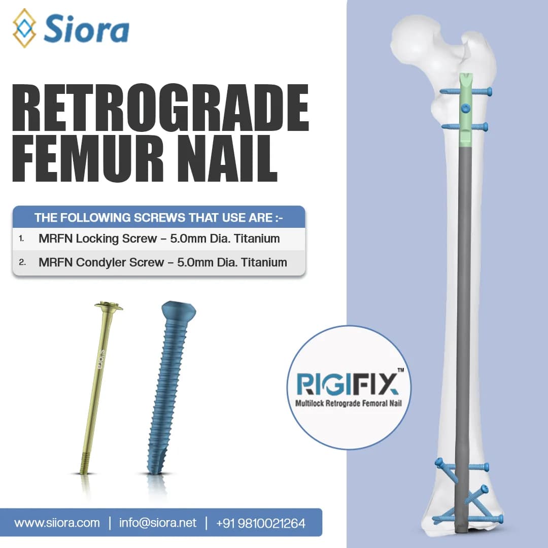Reliable Retrograde Femur Nails for Effective Distal Femur Fracture Fixation