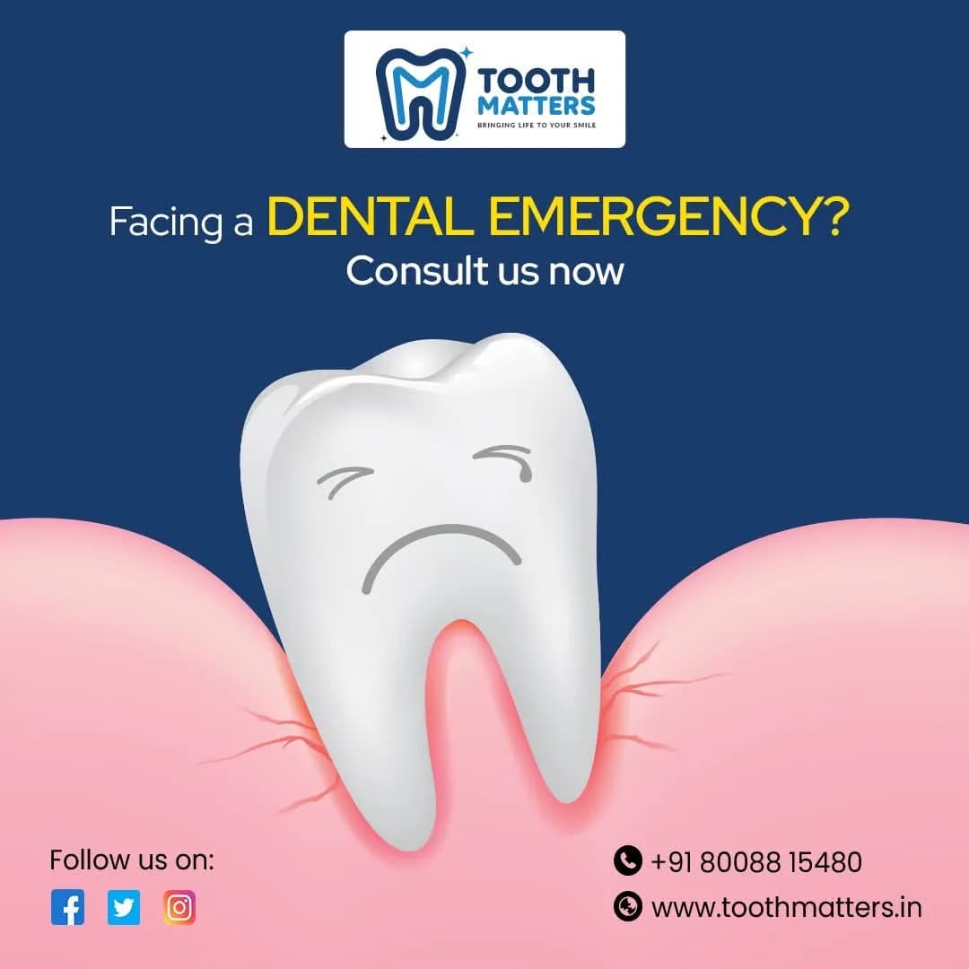 Best Dental Doctor Near Me for Advanced Root Canal Treatment | Tooth Matters