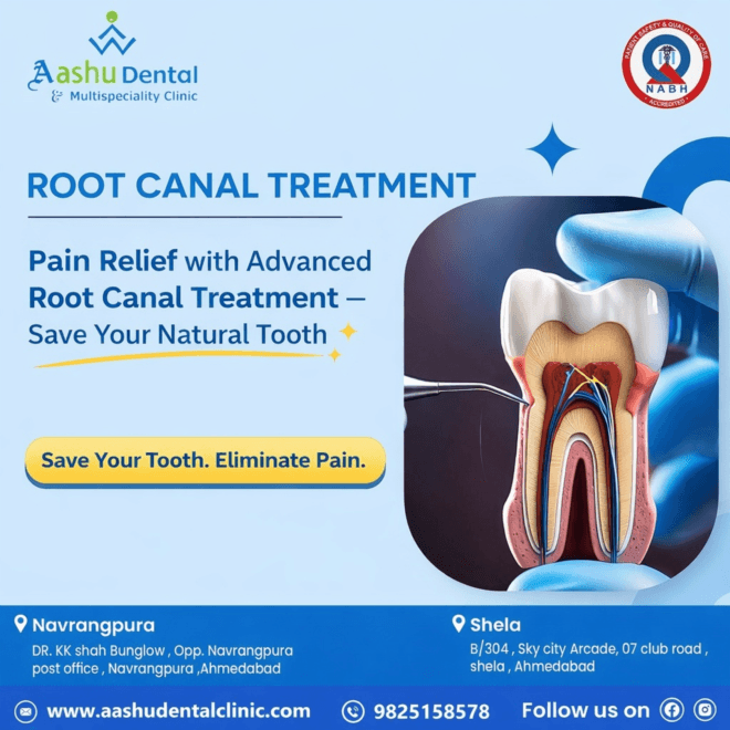India’s Leading Root Canal Treatment with High Success Rate