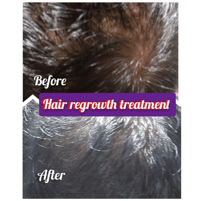 Painless Best laser hair reduction in Gurgaon at LOOK n SHAPE SKIN & HAIR CARE CLINIQ