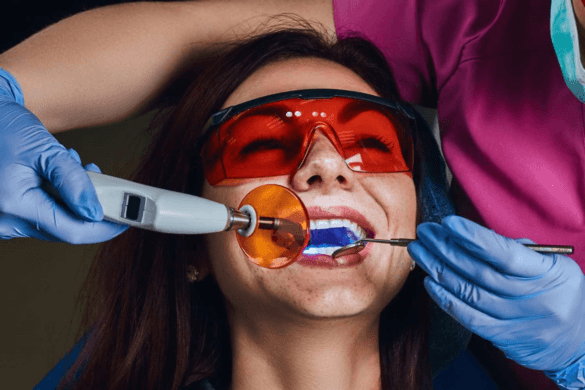 Expert Laser Dentists in Ahmedabad – Book Your Appointment