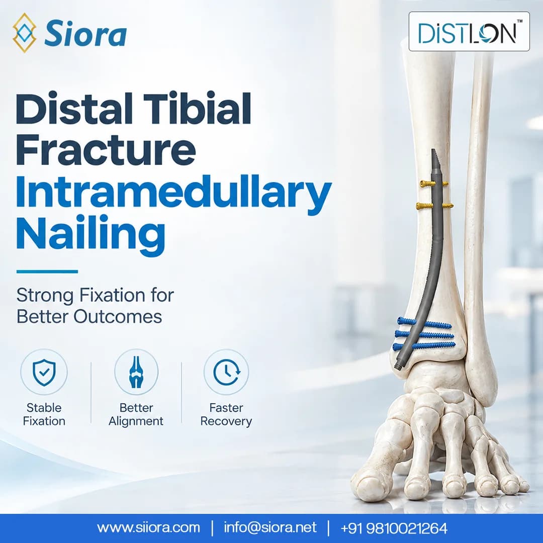 Reliable Intramedullary Nailing for Distal Tibial Fractures