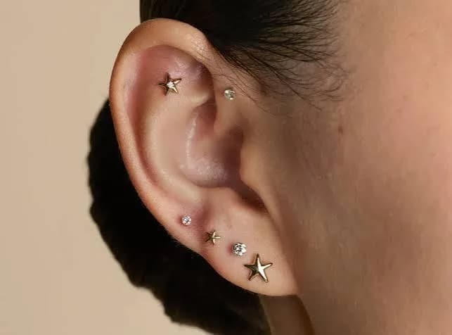 Can Earlobe Repair Restore a More Natural Earring Position?