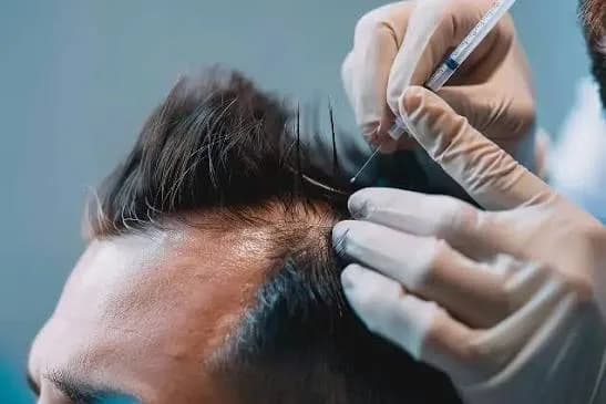 Discover a Smarter Path to Hair Restoration