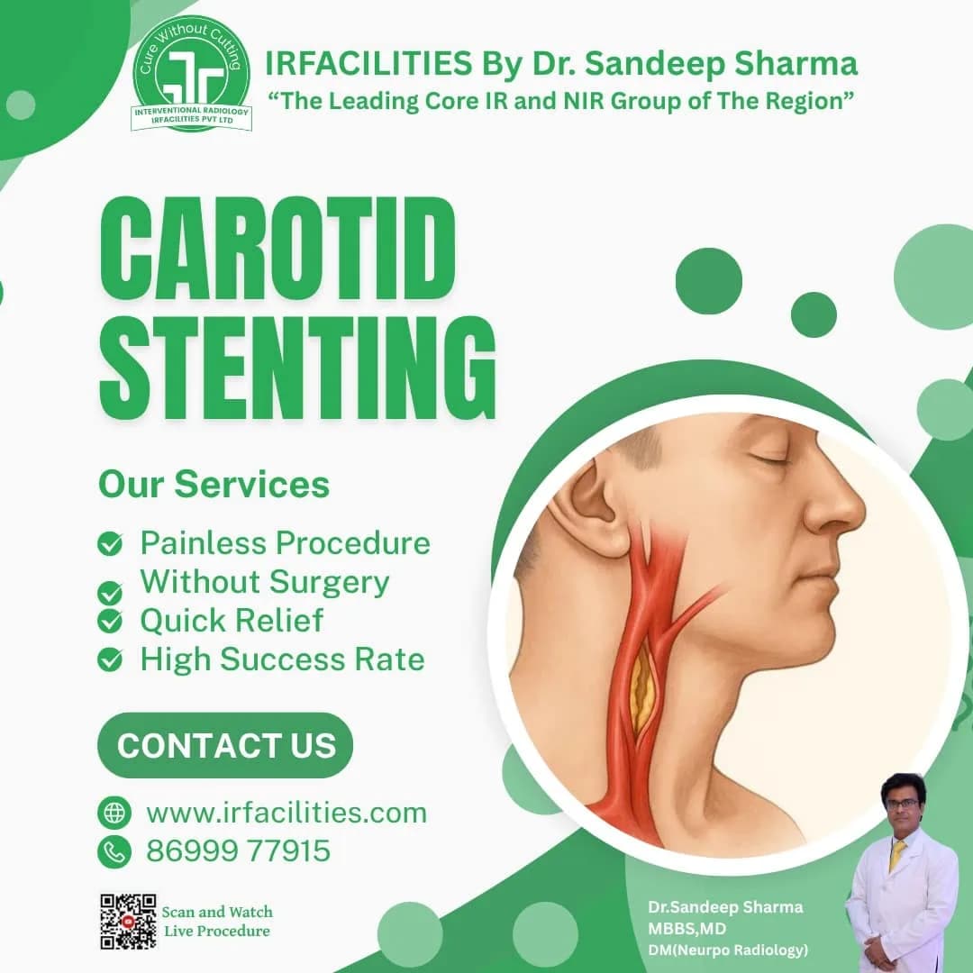 Carotid Angioplasty with Stent: New Way of Treating Stoke