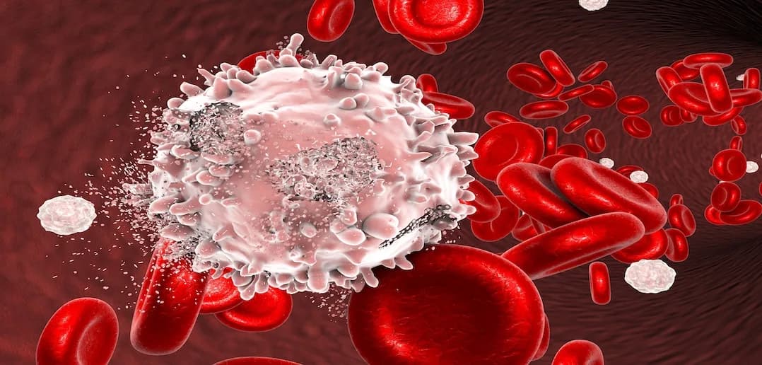 Expert Solutions for Blood Cancer Treatment in Noida