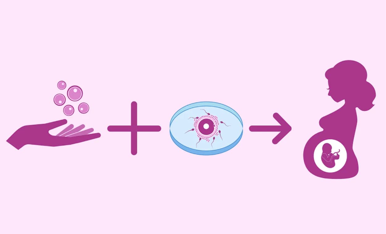 Donor IVF Programme in Delhi | A New Hope with Fertylity IVF