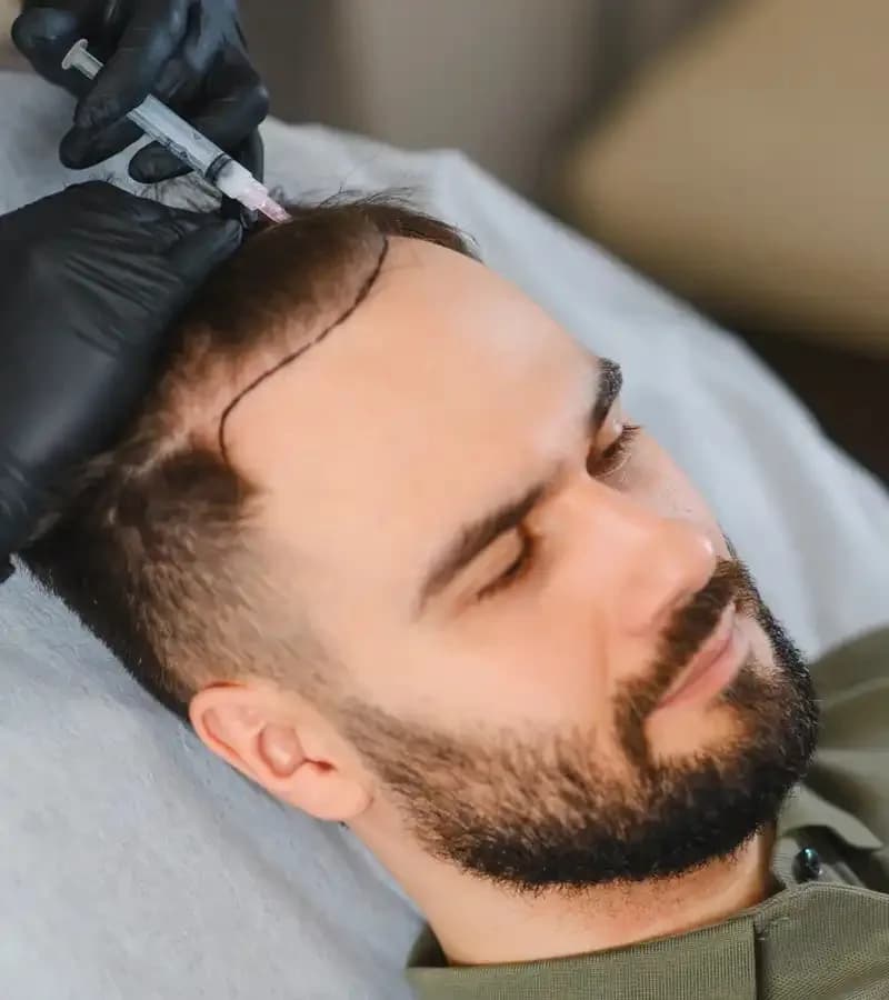 Failed Hair Transplant in Singapore: Causes, Solutions & Recovery Options