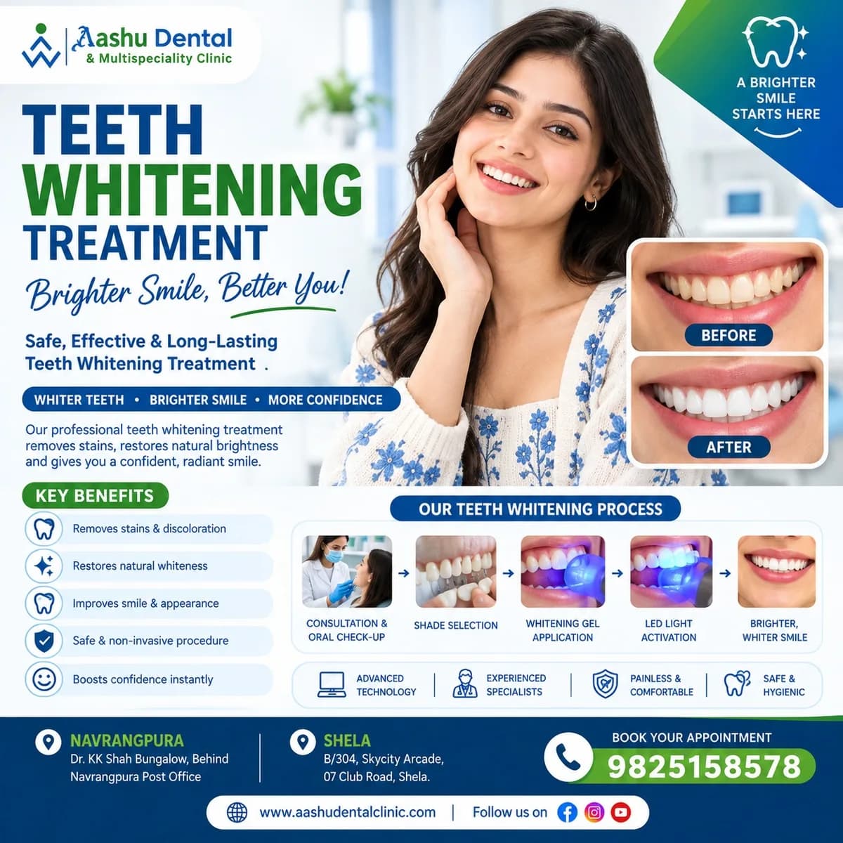 Teeth Whitening Clinic – Professional Smile Brightening Treatment