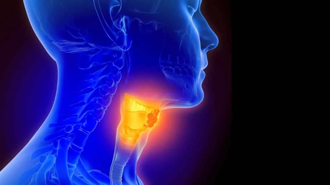 Head & Neck Cancer Treatment in Noida | Dr. Manish Singhal