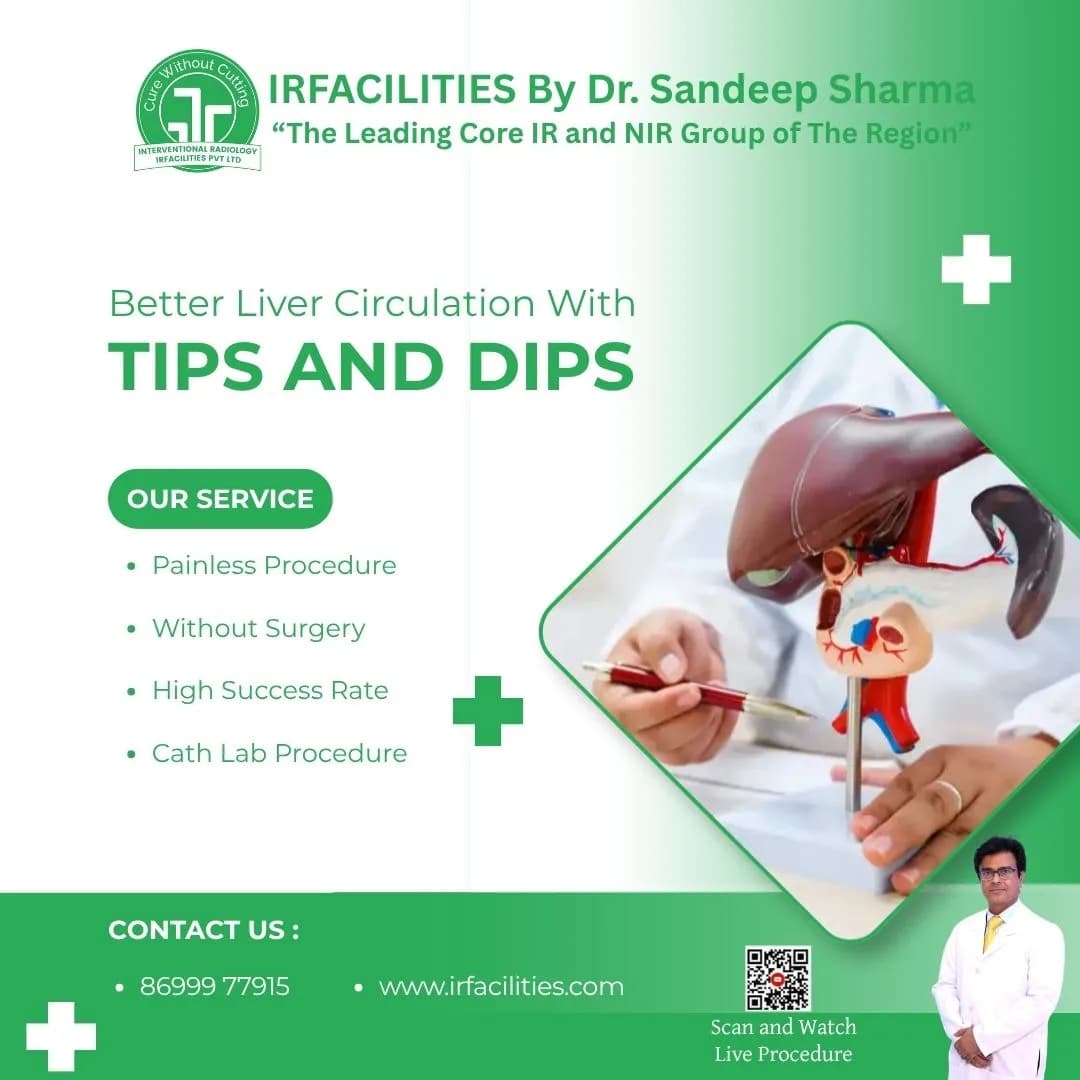 TIPS Procedure Radiology | Advanced Minimally Invasive Treatment