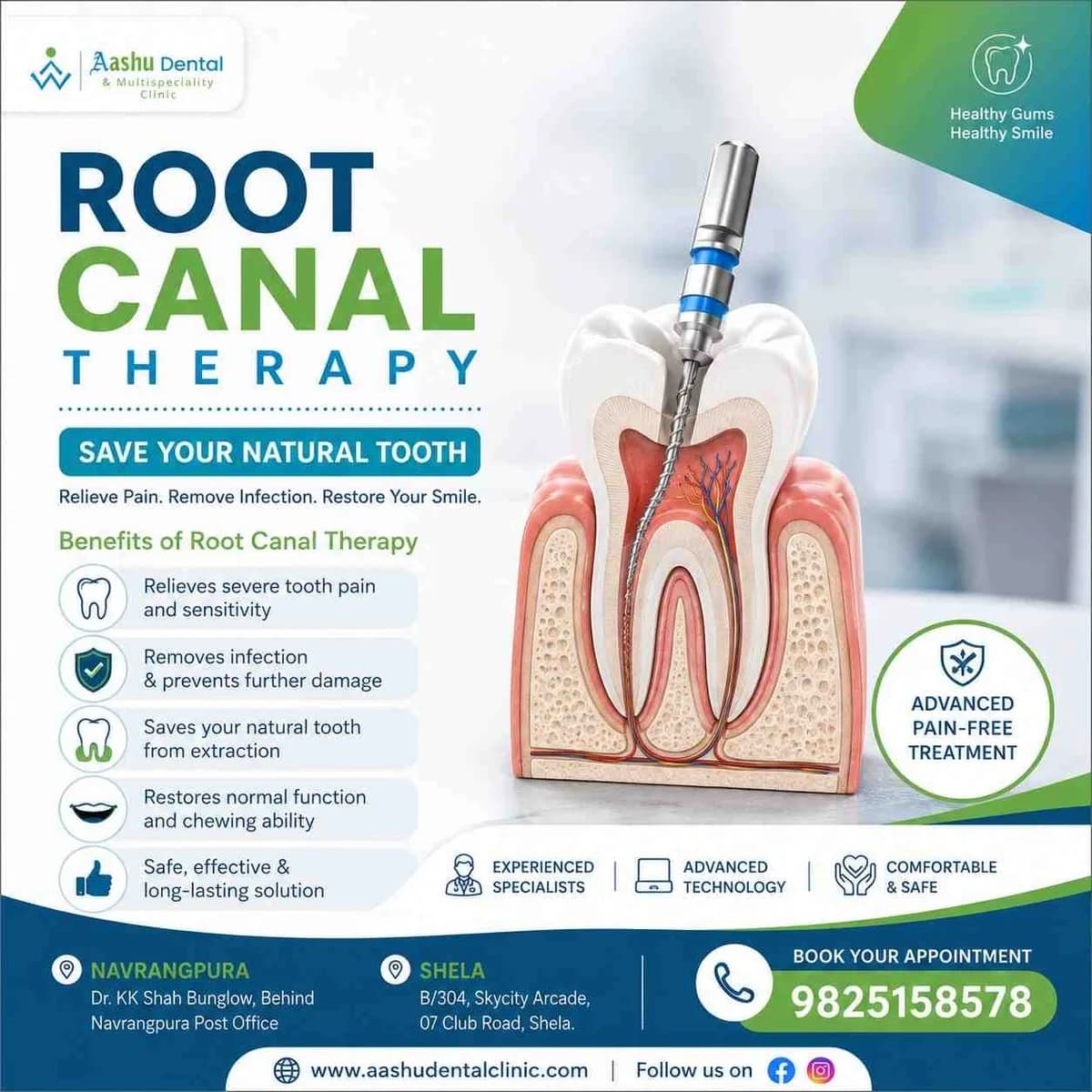 Get Rid of Tooth Pain with Expert Root Canal Therapy
