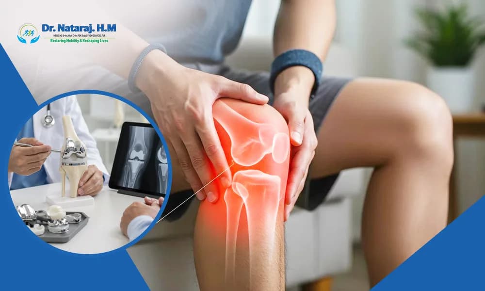 Experienced Partial Knee Replacement Surgeon in Bangalore - Dr. Nataraj H M