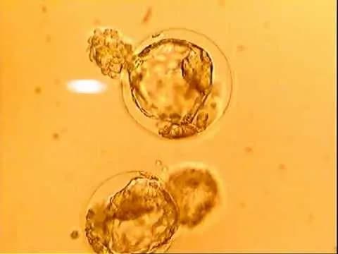 Blastocyst Transfer in Delhi with Personalized IVF Guidance | Fertylity IVF