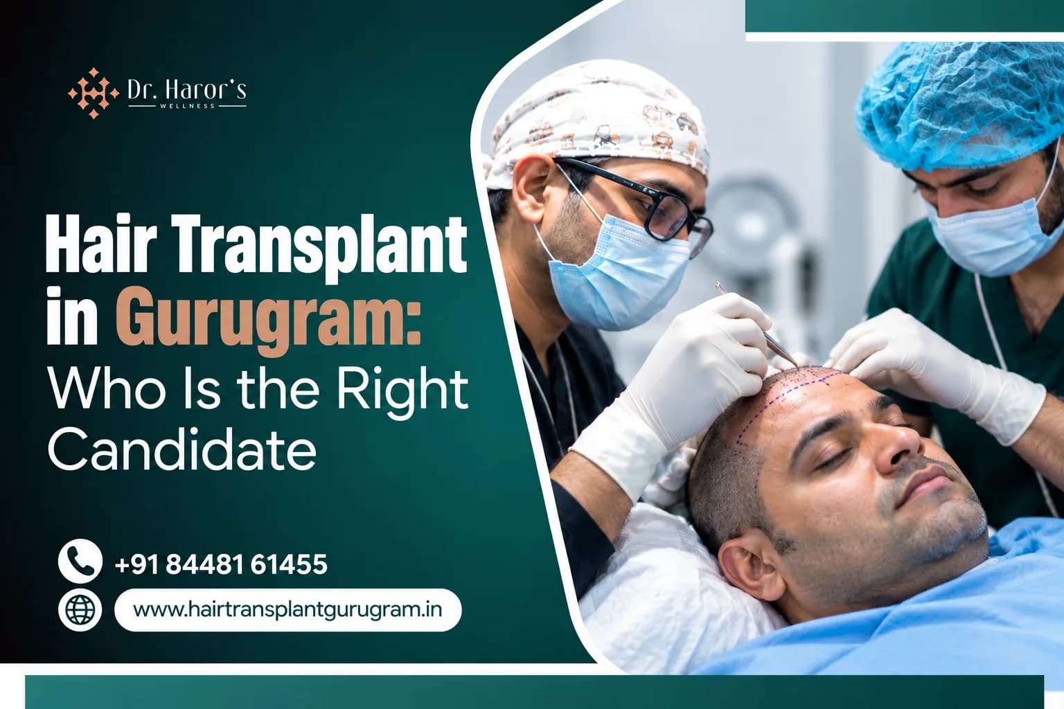Hair Transplant in Gurugram: Who Is the Right Candidate?