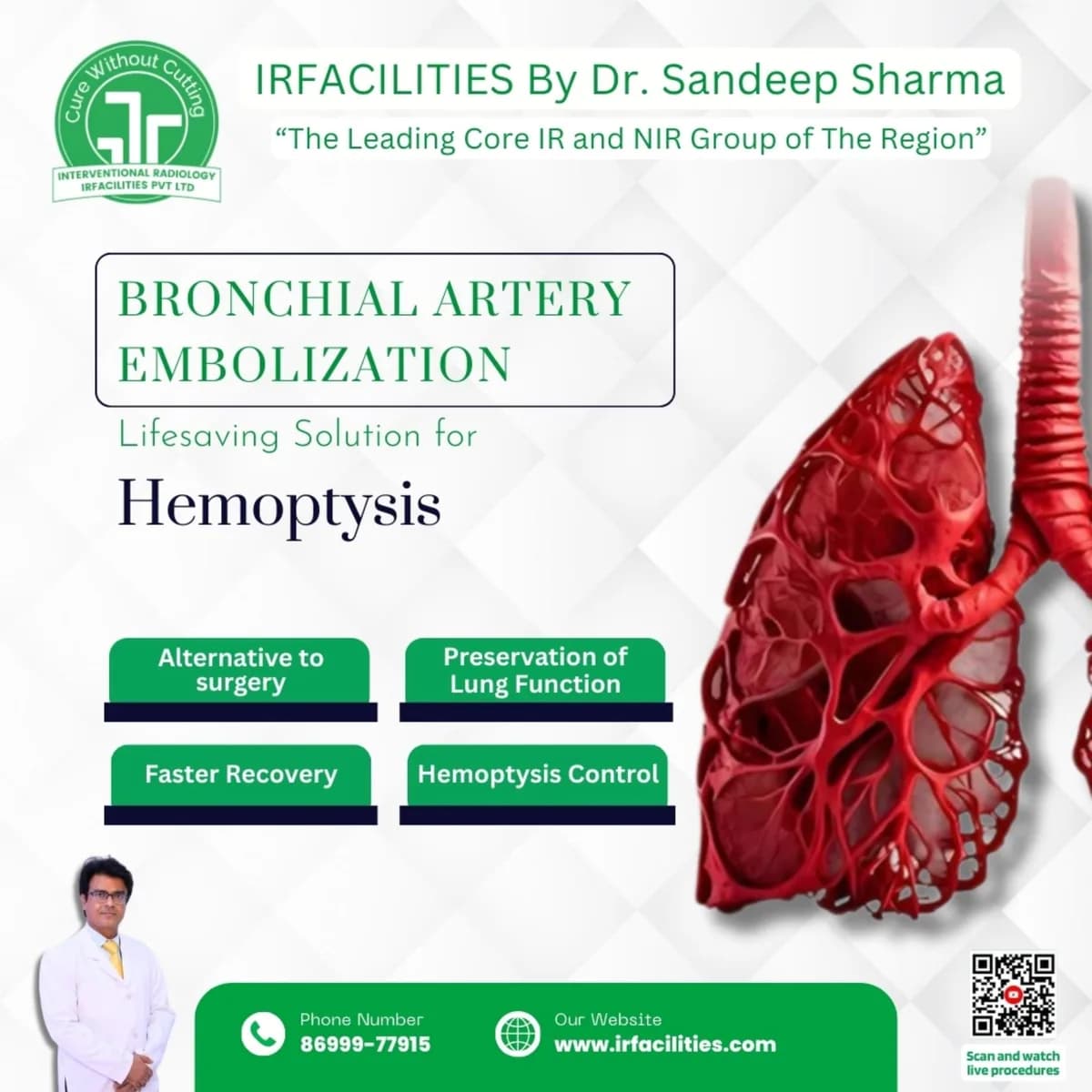 Bronchial Artery Embolization Radiology – Efficient Care